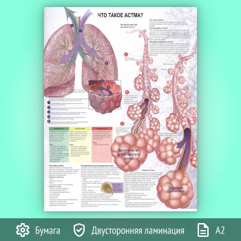 Плакат «Что такое астма?» (ЗОЖ-48, 1 лист, А2)